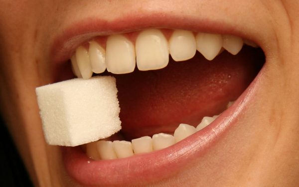 Caries - Cómo se forma y cómo prevenirlas