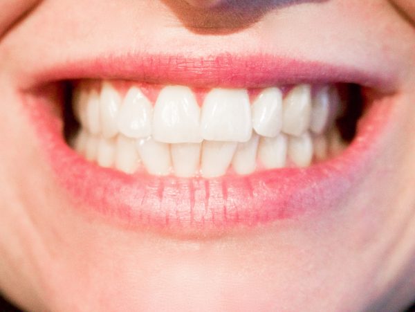 Reposición de dientes ausentes o extraídos