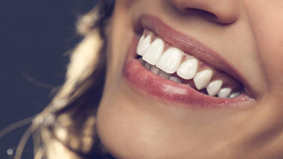 Ferulización dental